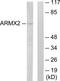 Armadillo Repeat Containing X-Linked 2 antibody, TA314971, Origene, Western Blot image 