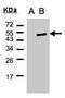 Cytohesin 1 antibody, GTX102825, GeneTex, Western Blot image 