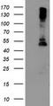 Lipoprotein Lipase antibody, TA503793, Origene, Western Blot image 