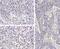 Interleukin 1 Beta antibody, A00101-2, Boster Biological Technology, Immunohistochemistry paraffin image 