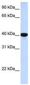 Glucose-6-Phosphatase Catalytic Subunit antibody, TA334652, Origene, Western Blot image 
