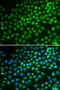 SWI/SNF Related, Matrix Associated, Actin Dependent Regulator Of Chromatin, Subfamily A, Member 5 antibody, 18-437, ProSci, Immunofluorescence image 