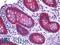Cadherin 17 antibody, LS-B6023, Lifespan Biosciences, Immunohistochemistry paraffin image 