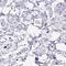 Calcium Binding Protein 39 Like antibody, HPA045954, Atlas Antibodies, Immunohistochemistry frozen image 