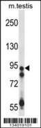 Ubiquitin Specific Peptidase 20 antibody, 57-765, ProSci, Western Blot image 