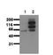 Catenin Beta 1 antibody, AM00016PU-N, Origene, Western Blot image 