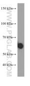 Human IgA antibody, 60099-1-Ig, Proteintech Group, Western Blot image 