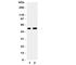 Early growth response protein 2 antibody, R31299, NSJ Bioreagents, Western Blot image 
