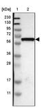 Growth Differentiation Factor 5 antibody, PA5-53358, Invitrogen Antibodies, Western Blot image 