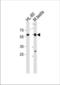 Retinoic Acid Receptor Alpha antibody, TA324529, Origene, Western Blot image 
