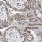 Keratin Associated Protein 25-1 antibody, NBP1-93664, Novus Biologicals, Immunohistochemistry frozen image 