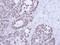 Nuclear RNA Export Factor 1 antibody, GTX102071, GeneTex, Immunohistochemistry paraffin image 