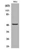 Nuclear Transcription Factor Y Subunit Gamma antibody, orb161992, Biorbyt, Western Blot image 