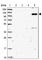RAB11 Binding And LisH Domain, Coiled-Coil And HEAT Repeat Containing antibody, HPA039708, Atlas Antibodies, Western Blot image 
