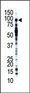 Ubiquitin carboxyl-terminal hydrolase 13 antibody, AP12027PU-N, Origene, Western Blot image 