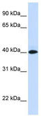 V-set and immunoglobulin domain-containing protein 8 antibody, TA336094, Origene, Western Blot image 