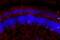 Usherin antibody, DZ01481, Boster Biological Technology, Immunofluorescence image 