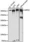 Multiple PDZ domain protein antibody, A15344, ABclonal Technology, Western Blot image 