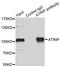 ATR Interacting Protein antibody, LS-C346249, Lifespan Biosciences, Immunoprecipitation image 