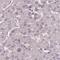 Chromosome 1 Open Reading Frame 56 antibody, NBP1-82174, Novus Biologicals, Immunohistochemistry paraffin image 