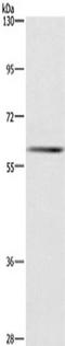 Glucokinase regulatory protein antibody, TA351218, Origene, Western Blot image 