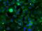Sorting Nexin 9 antibody, NBP2-02609, Novus Biologicals, Immunocytochemistry image 