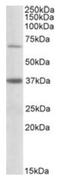 Carnitine O-palmitoyltransferase 2, mitochondrial antibody, AP10041PU-N, Origene, Western Blot image 