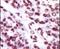 Protein Kinase C Epsilon antibody, PA5-13745, Invitrogen Antibodies, Immunohistochemistry paraffin image 