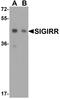 Single Ig And TIR Domain Containing antibody, A03373, Boster Biological Technology, Western Blot image 