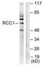Regulator Of Chromosome Condensation 1 antibody, TA313618, Origene, Western Blot image 