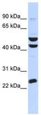 Zinc Finger Protein 200 antibody, TA343406, Origene, Western Blot image 