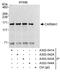 Caspase recruitment domain-containing protein 11 antibody, A302-542A, Bethyl Labs, Immunoprecipitation image 