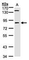 LIM Domain Kinase 2 antibody, orb74156, Biorbyt, Western Blot image 