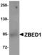 Zinc Finger BED-Type Containing 1 antibody, A11133, Boster Biological Technology, Western Blot image 