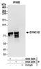 Cytoplasmic dynein 1 intermediate chain 2 antibody, A304-529A, Bethyl Labs, Immunoprecipitation image 