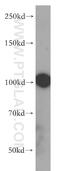 Microtubule Associated Protein 7 antibody, 13446-1-AP, Proteintech Group, Western Blot image 