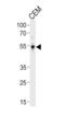 Kruppel Like Factor 5 antibody, orb376094, Biorbyt, Western Blot image 