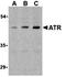 ATR Serine/Threonine Kinase antibody, orb74494, Biorbyt, Western Blot image 