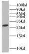 MAGE Family Member H1 antibody, FNab04951, FineTest, Western Blot image 