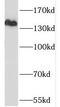 Sterol regulatory element-binding protein cleavage-activating protein antibody, FNab07622, FineTest, Western Blot image 