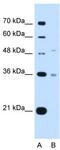 Uronyl 2-Sulfotransferase antibody, TA339020, Origene, Western Blot image 