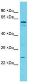 Thioredoxin Domain Containing 9 antibody, TA332051, Origene, Western Blot image 