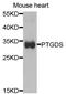 Prostaglandin D2 Synthase antibody, abx006703, Abbexa, Western Blot image 