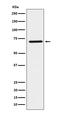 Hnf-1b antibody, M01270-1, Boster Biological Technology, Western Blot image 