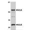 Protein kinase domain-containing protein, cytoplasmic antibody, TA306903, Origene, Western Blot image 
