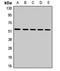 Mitochondrially Encoded NADH:Ubiquinone Oxidoreductase Core Subunit 4 antibody, orb412930, Biorbyt, Western Blot image 