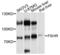 Follicle-stimulating hormone receptor antibody, LS-C331489, Lifespan Biosciences, Western Blot image 