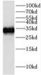 Insulin Like Growth Factor Binding Protein 2 antibody, FNab04177, FineTest, Western Blot image 