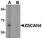 Zinc finger and SCAN domain-containing protein 4 antibody, TA306927, Origene, Western Blot image 