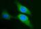 Sphingosine Kinase 1 antibody, NBP2-45944, Novus Biologicals, Immunocytochemistry image 